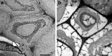 Đánh giá khả năng co rút và giãn nở của gỗ khảo cổ được bảo quản bằng natri polyacrylate